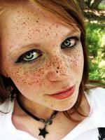 Lots of freckles