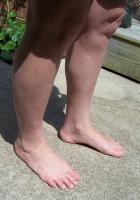 2008 - Linda's Feet