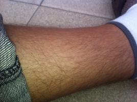 My hairy Legs 2